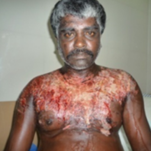 wellcare international hospital trichy wellcare international hospital trichy