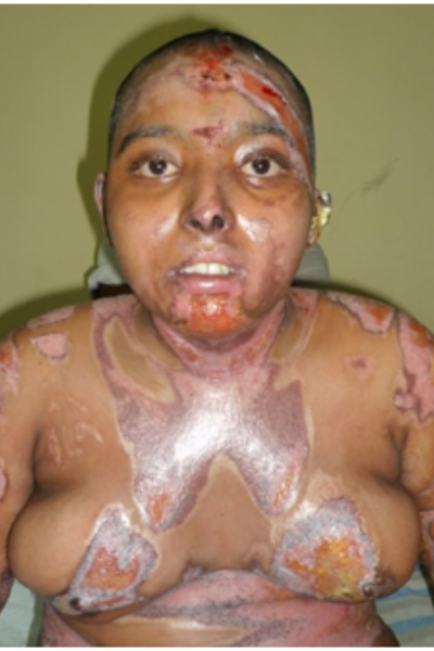 wellcare international hospital trichy wellcare international hospital trichy