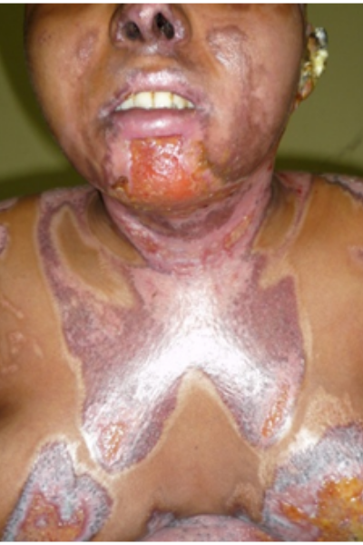 wellcare international hospital trichy wellcare international hospital trichy