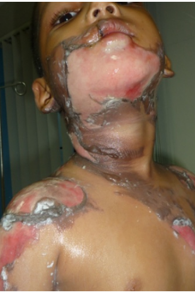 wellcare international hospital trichy wellcare international hospital trichy