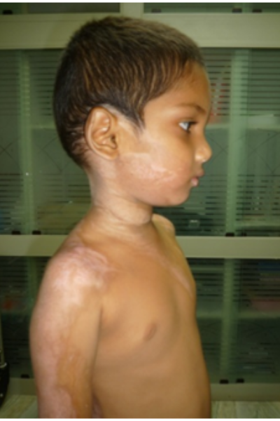 wellcare international hospital trichy wellcare international hospital trichy