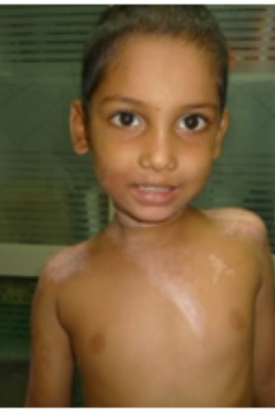 wellcare international hospital trichy wellcare international hospital trichy