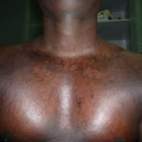 wellcare international hospital trichy wellcare international hospital trichy