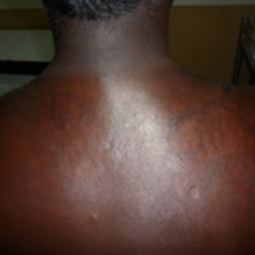 wellcare international hospital trichy wellcare international hospital trichy