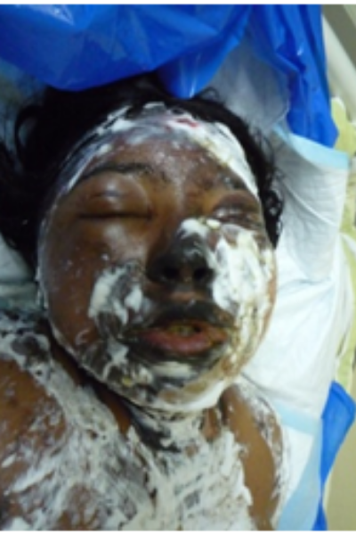 wellcare international hospital trichy wellcare international hospital trichy