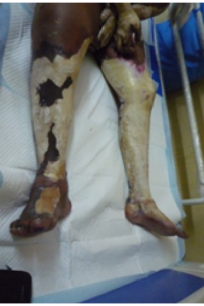 wellcare international hospital trichy wellcare international hospital trichy