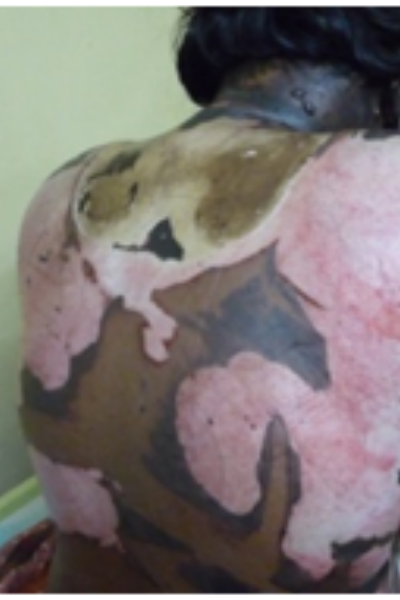 wellcare international hospital trichy wellcare international hospital trichy