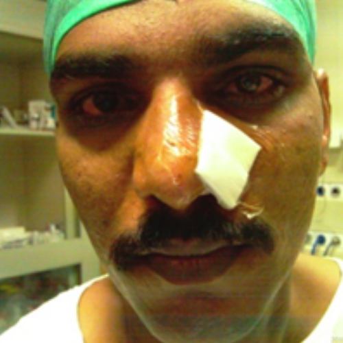 wellcare international hospital trichy wellcare international hospital trichy