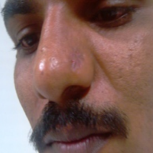wellcare international hospital trichy wellcare international hospital trichy