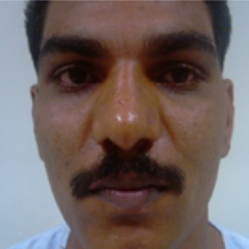 wellcare international hospital trichy wellcare international hospital trichy