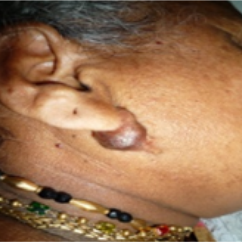 wellcare international hospital trichy wellcare international hospital trichy