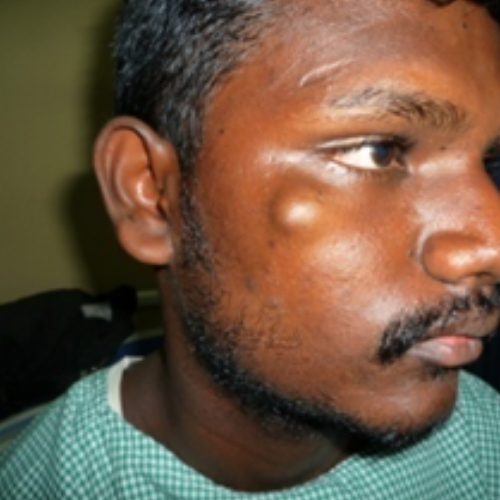 wellcare international hospital trichy wellcare international hospital trichy