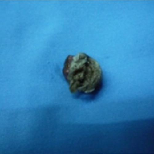 wellcare international hospital trichy wellcare international hospital trichy
