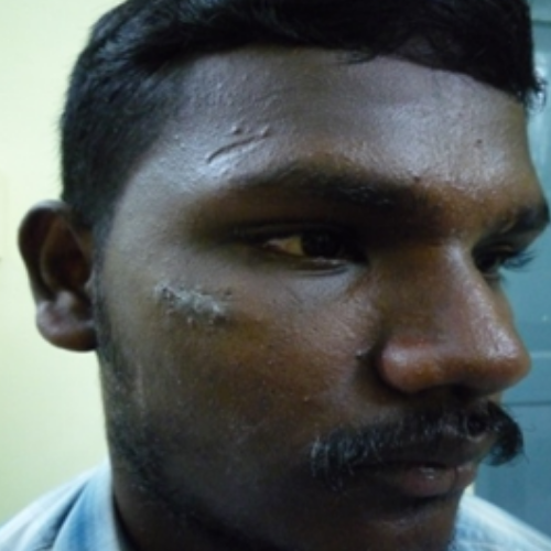 wellcare international hospital trichy wellcare international hospital trichy