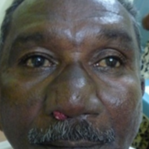 wellcare international hospital trichy wellcare international hospital trichy