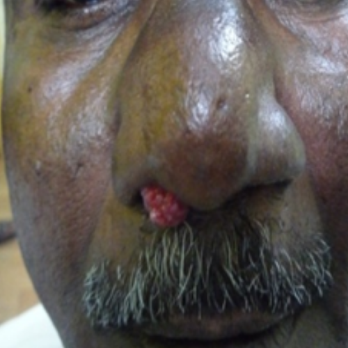 wellcare international hospital trichy wellcare international hospital trichy