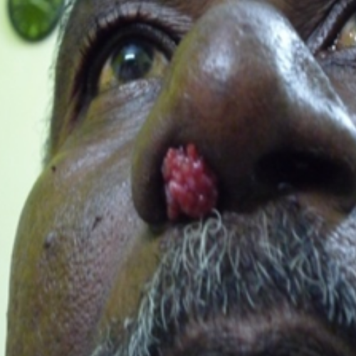 wellcare international hospital trichy wellcare international hospital trichy