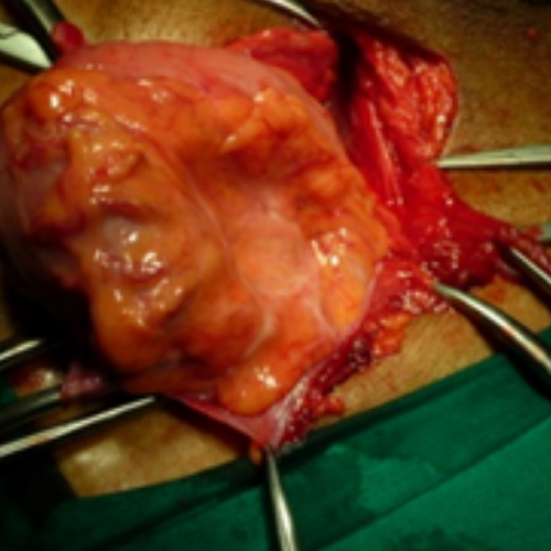 wellcare international hospital trichy wellcare international hospital trichy