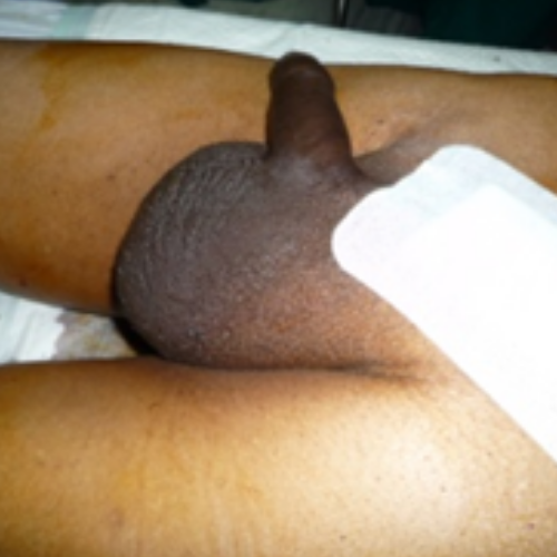 wellcare international hospital trichy wellcare international hospital trichy