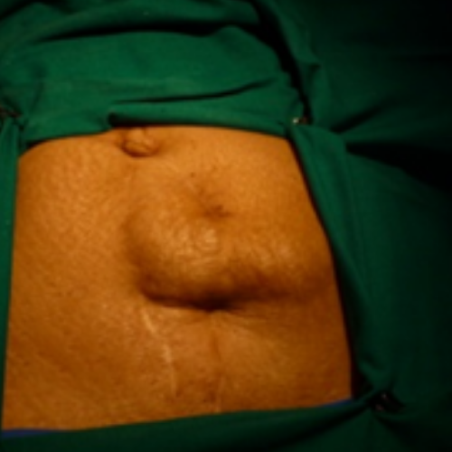 wellcare international hospital trichy wellcare international hospital trichy