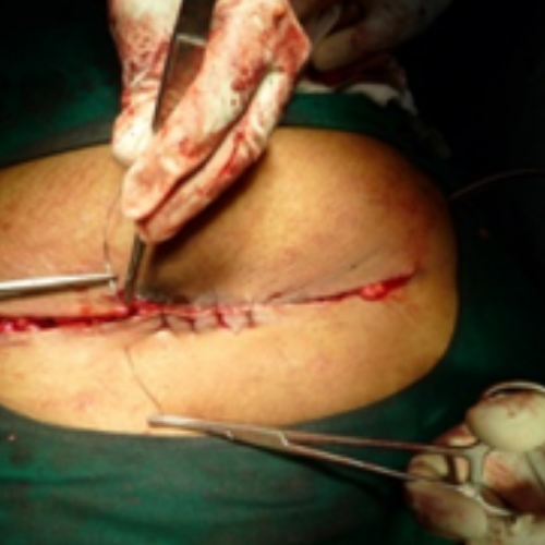 wellcare international hospital trichy wellcare international hospital trichy