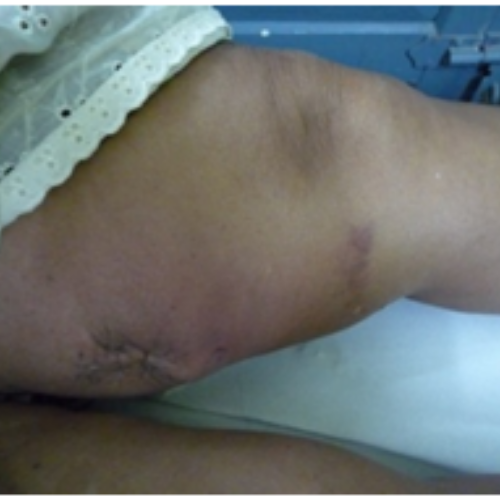 wellcare international hospital trichy wellcare international hospital trichy