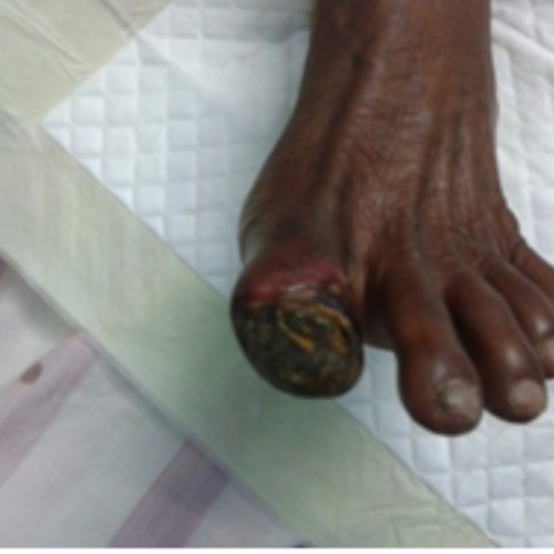 wellcare international hospital trichy wellcare international hospital trichy