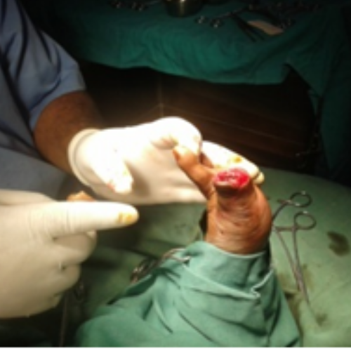 wellcare international hospital trichy wellcare international hospital trichy