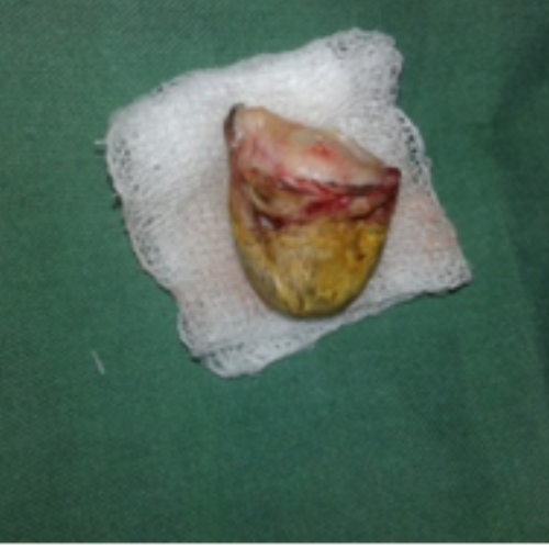 wellcare international hospital trichy wellcare international hospital trichy