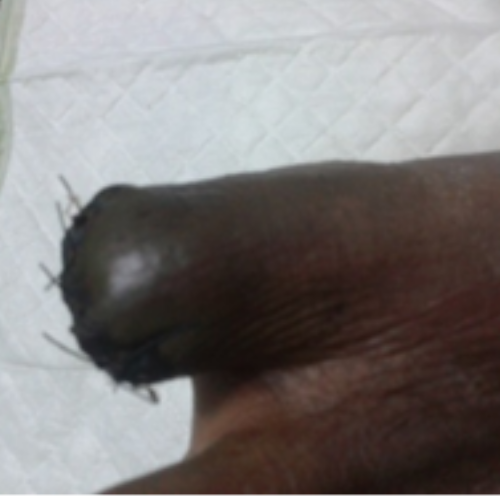 wellcare international hospital trichy wellcare international hospital trichy