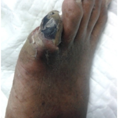 wellcare international hospital trichy wellcare international hospital trichy