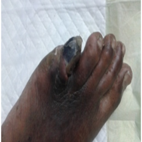 wellcare international hospital trichy wellcare international hospital trichy