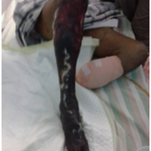 wellcare international hospital trichy wellcare international hospital trichy