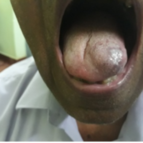 wellcare international hospital trichy wellcare international hospital trichy