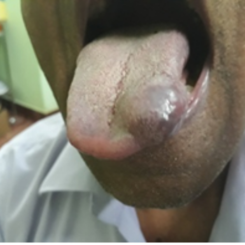 wellcare international hospital trichy wellcare international hospital trichy