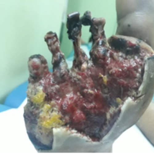 wellcare international hospital trichy wellcare international hospital trichy