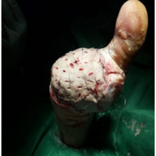 wellcare international hospital trichy wellcare international hospital trichy