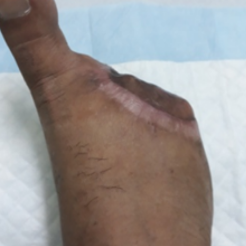 wellcare international hospital trichy wellcare international hospital trichy