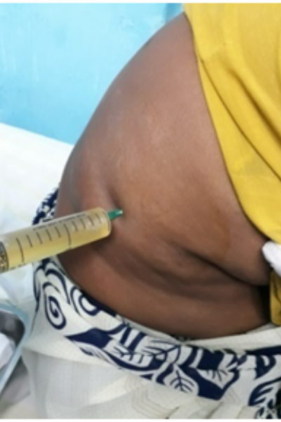 wellcare international hospital trichy wellcare international hospital trichy