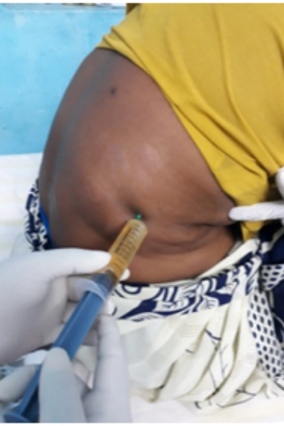 wellcare international hospital trichy wellcare international hospital trichy
