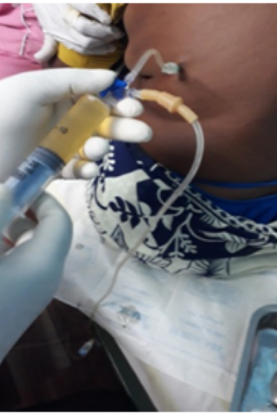 wellcare international hospital trichy wellcare international hospital trichy