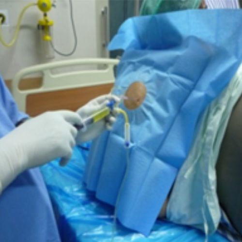 wellcare international hospital trichy wellcare international hospital trichy