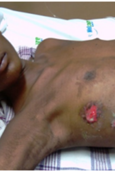 wellcare international hospital trichy wellcare international hospital trichy