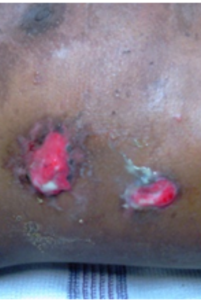 wellcare international hospital trichy wellcare international hospital trichy