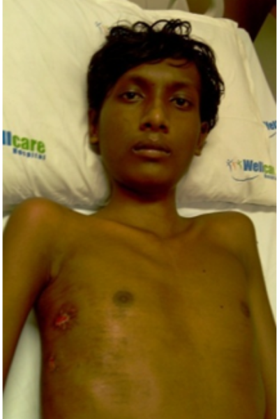 wellcare international hospital trichy wellcare international hospital trichy