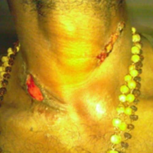 wellcare international hospital trichy wellcare international hospital trichy