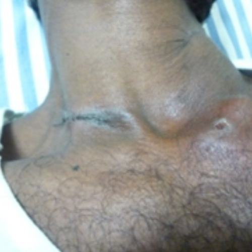 wellcare international hospital trichy wellcare international hospital trichy