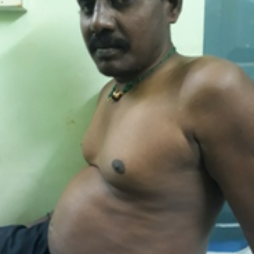 wellcare international hospital trichy wellcare international hospital trichy