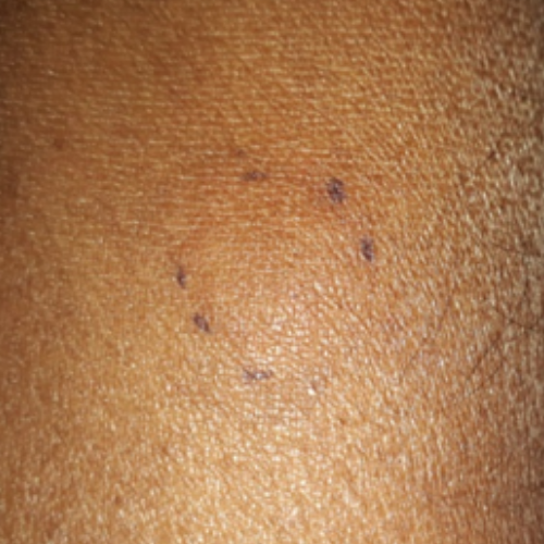 wellcare international hospital trichy wellcare international hospital trichy