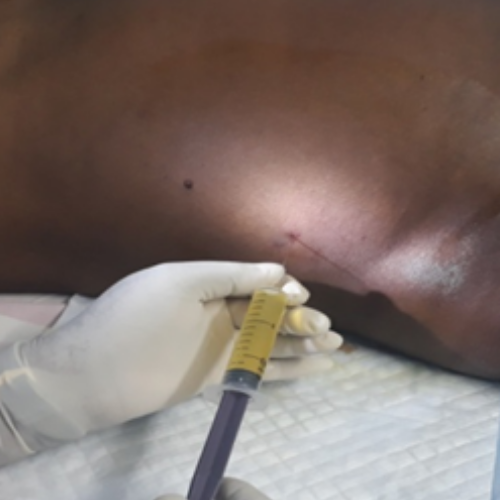 wellcare international hospital trichy wellcare international hospital trichy